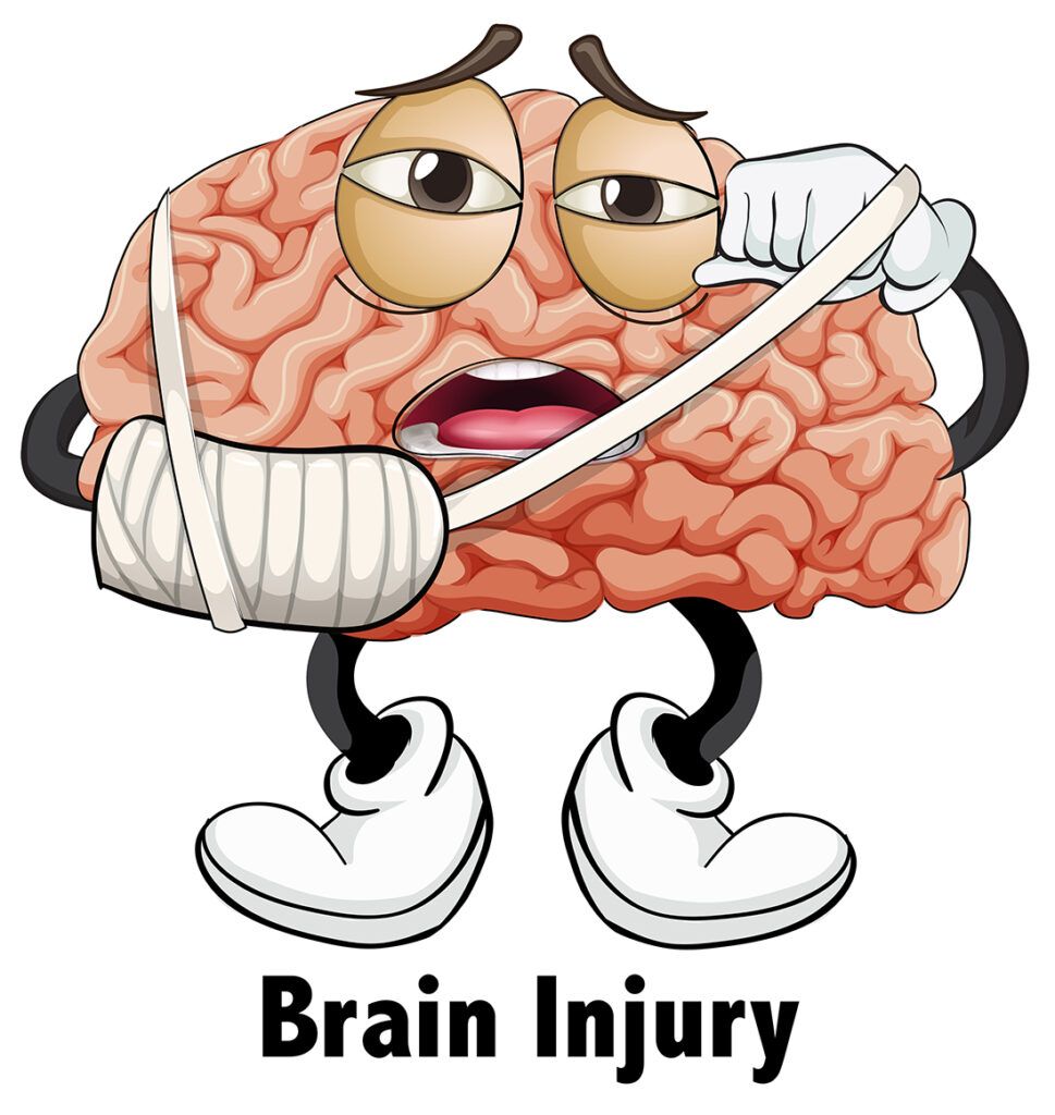 Examples of Traumatic Brain Injuries Resulting from Accidents